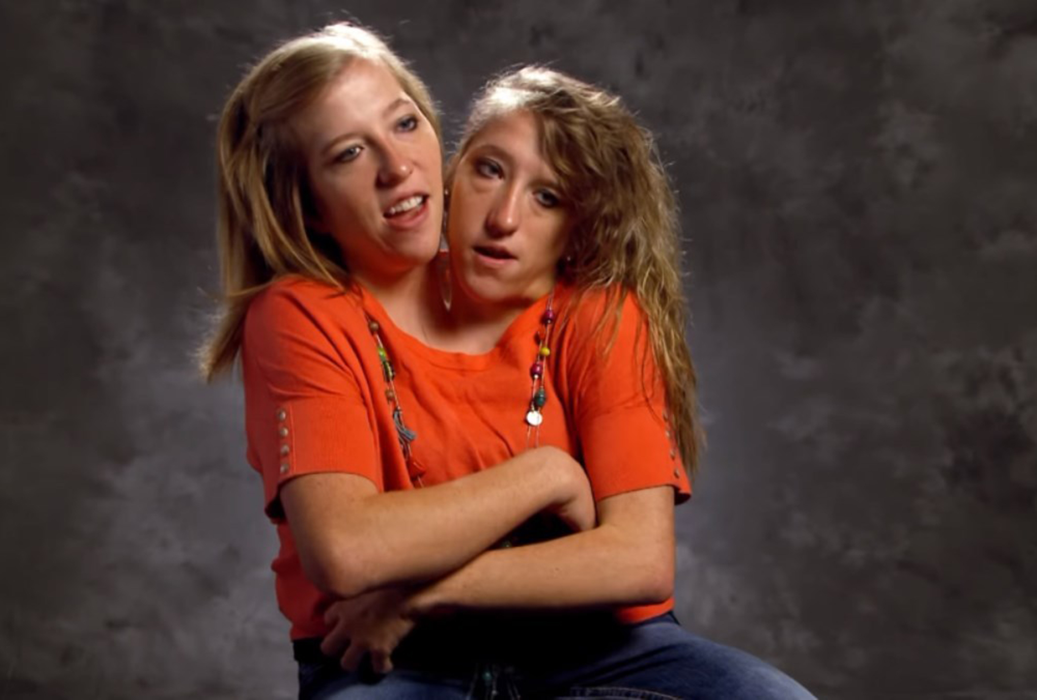 What Conjoined Twins Abby And Brittany Hensel Look Like Today In 2020