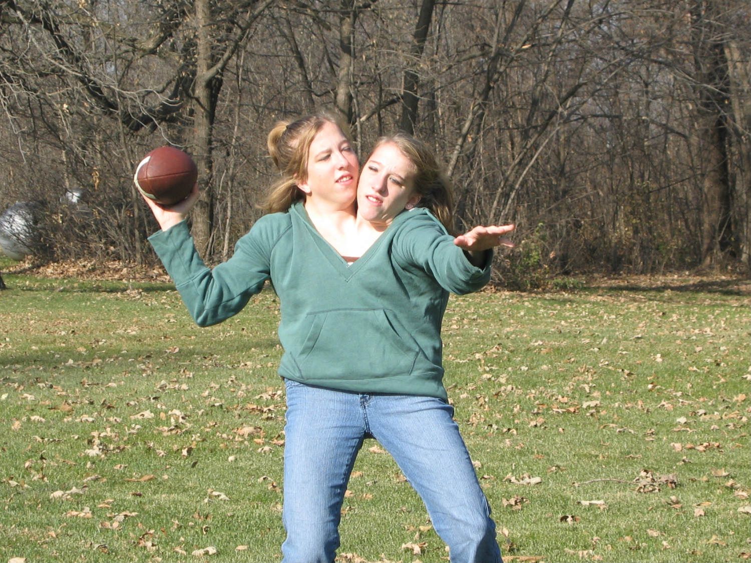 What Famous Conjoined Twins Abby And Brittany Hensel are Doing Today