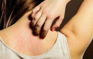 Experiencing These Symptoms? It Could Mean Too Much Sugar In Your Diet