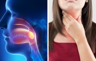 The Best Way To Deal With Itchy Throats