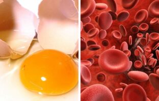 Researchers And Dietitians Have Concluded That Eggs Do Not Cause Blood Clots